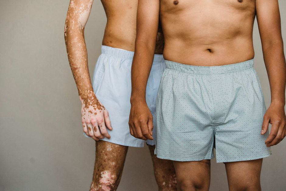 what does plaque psoriasis look like