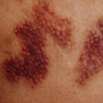 what does the capillaries do
