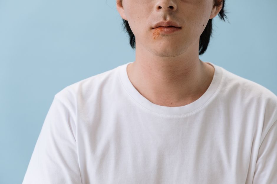 what is a 4th degree burn symptoms and treatment