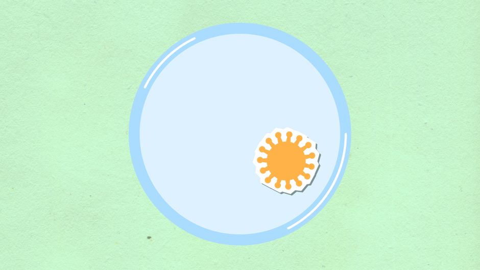 what is a basophil