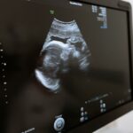 what is a normal liver suv on a pet scan