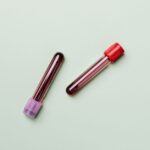 what is a serum sample and how is it used