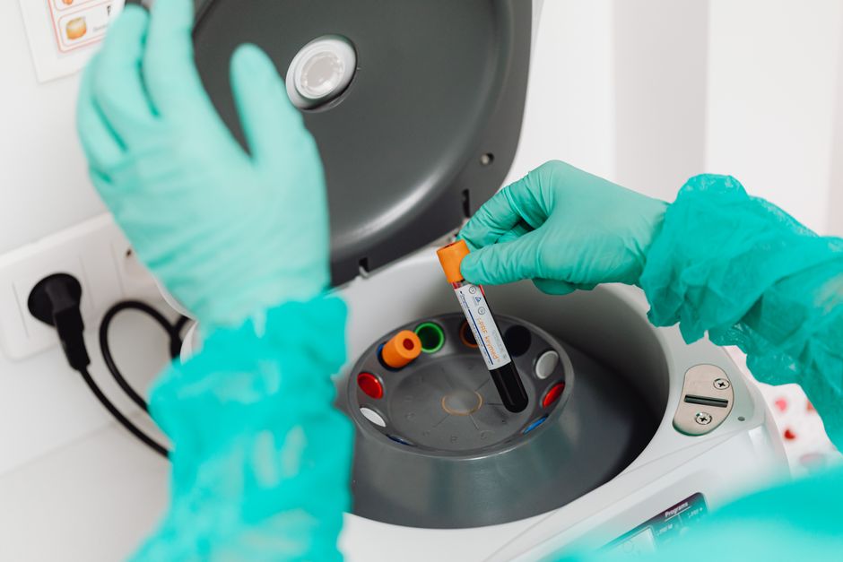 what is ana laboratory test