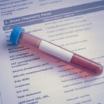 what is bilirubin in a blood test levels causes