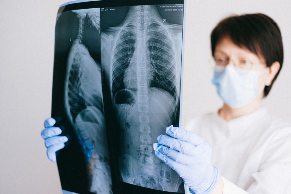 what is doppler imaging and what can it detect