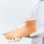 what is dry needling procedure uses and risks