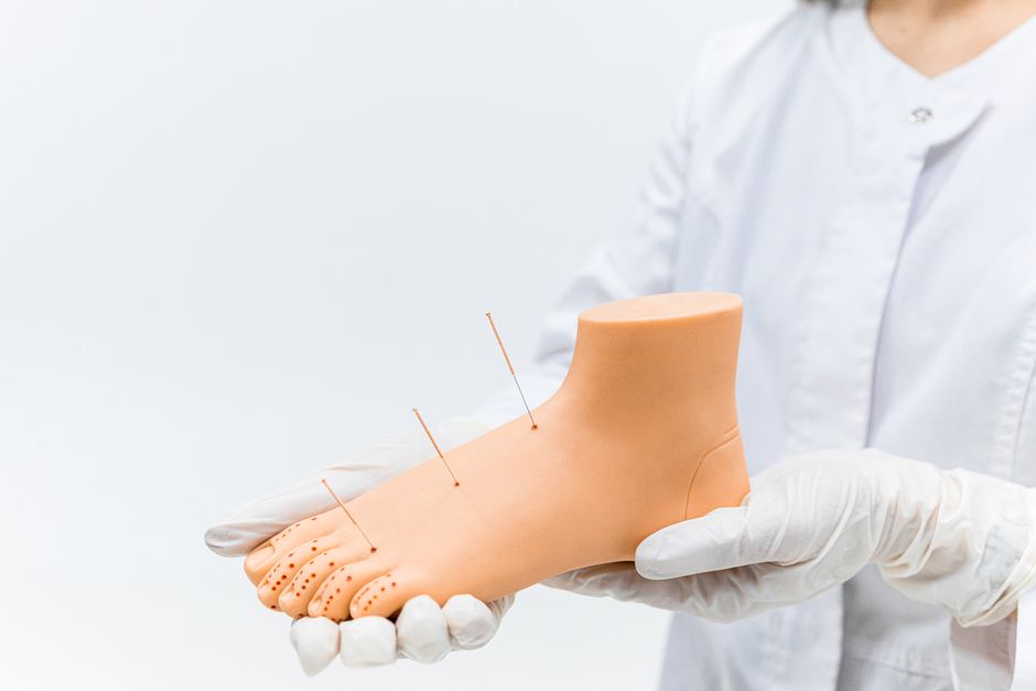 what is dry needling procedure uses and risks