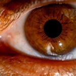 what is genetic mosaicism and how does it happen