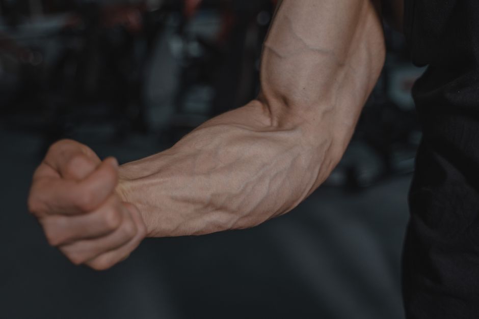 what is limb girdle muscular dystrophy symptoms treatment