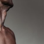 what is occipital neuralgia
