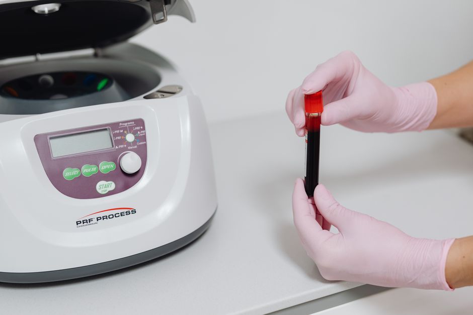 what is platelet aggregation and how does it work