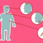 what rabies does to a person symptoms to death