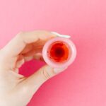 what to expect during a cervical conization procedure