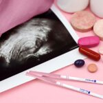 what to expect from a cystoscopy after bcg treatment