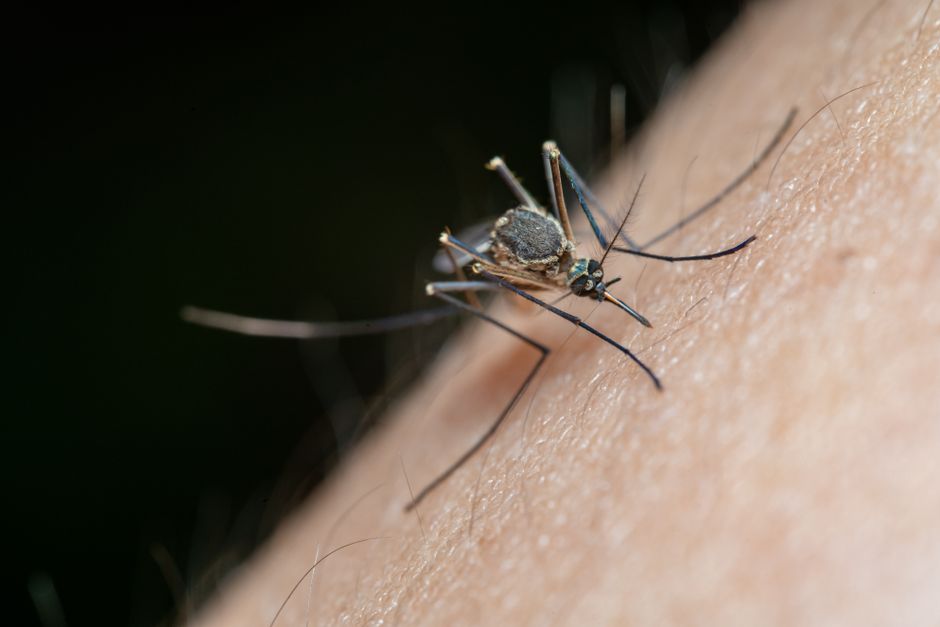 what to put on mosquito bites to stop itching
