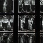 when should i see a neurologist for sciatica