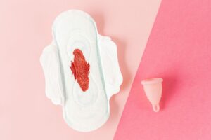 Why Am I Late On My Period? Causes And When To Worry 3 why am i late on my period causes and when to worry
