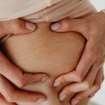 why are your stretch marks red