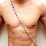 why do i have dots on my chest common causes