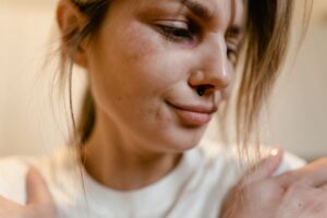 Why Is My Piercing Bruised? Causes And Healing Tips 6 why is my piercing bruised causes and healing tips