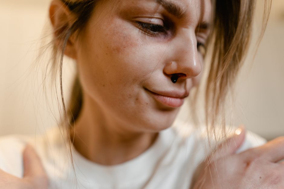 why is my piercing bruised causes and healing tips