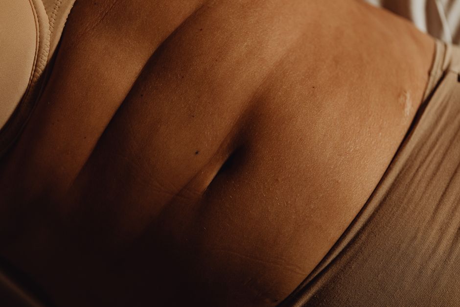 why is my stoma protruding and what should i do