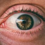why is my stye getting bigger causes and care