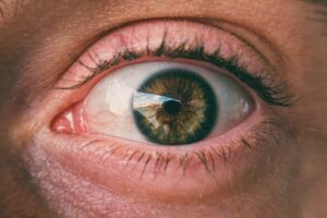 Why Is My Stye Getting Bigger Causes And Care? Root Causes 8 why is my stye getting bigger causes and care