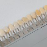 can you whiten dentin truth and treatment options