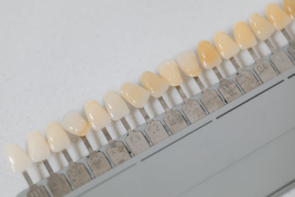 can you whiten dentin truth and treatment options