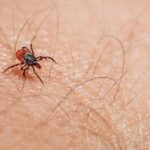 do most people have parasites