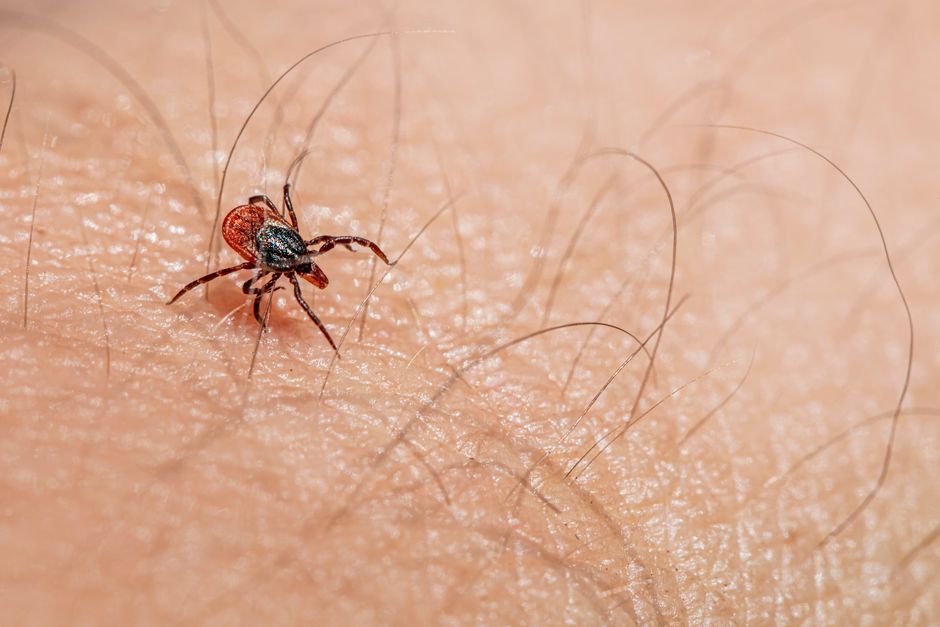 do most people have parasites