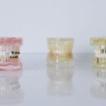 how do braces work from brackets to retainers