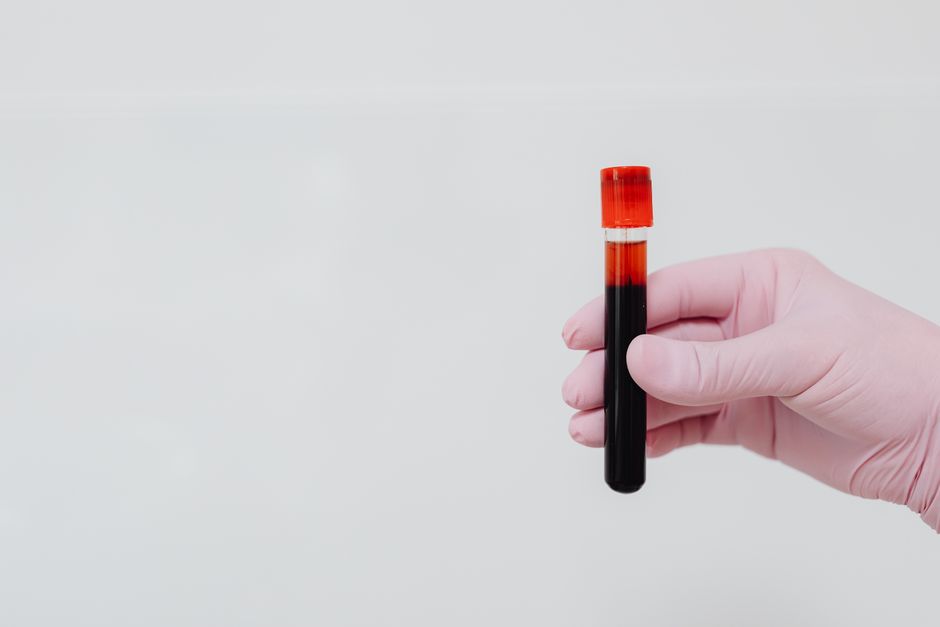 how do you increase white blood cells