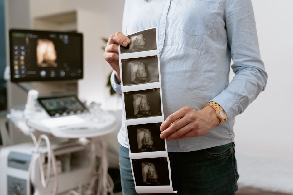how does ultrasound imaging work