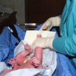 how long does umbilical cord take to fall off