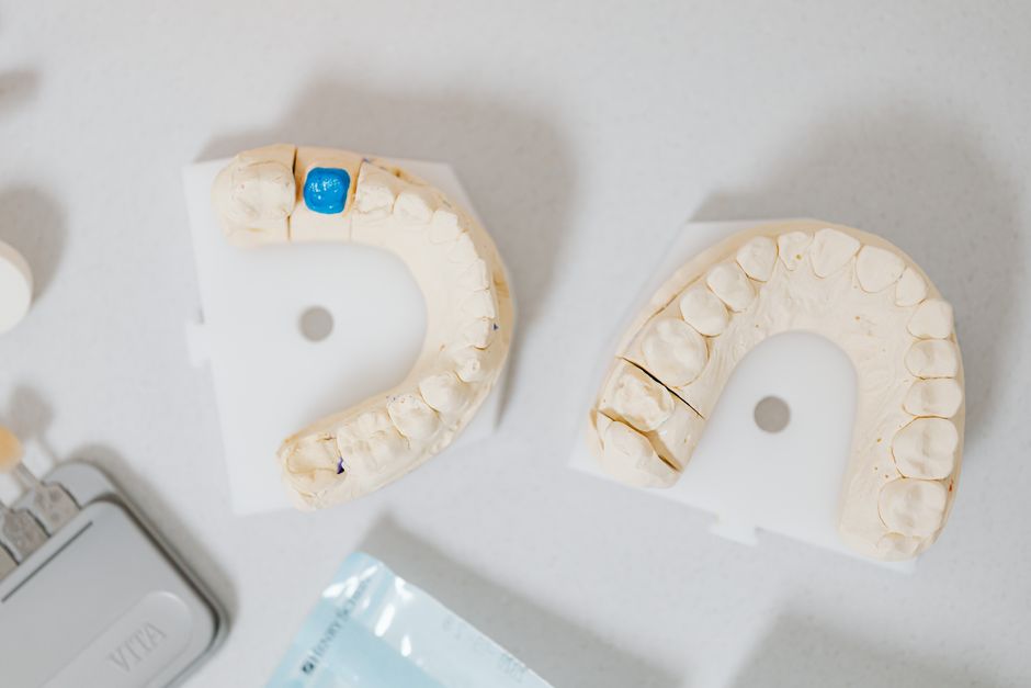 how much should a tooth crown cost