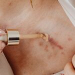 how to cover alopecia spots