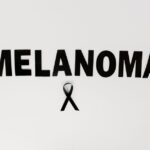 how to detect melanoma early abcde rule and more