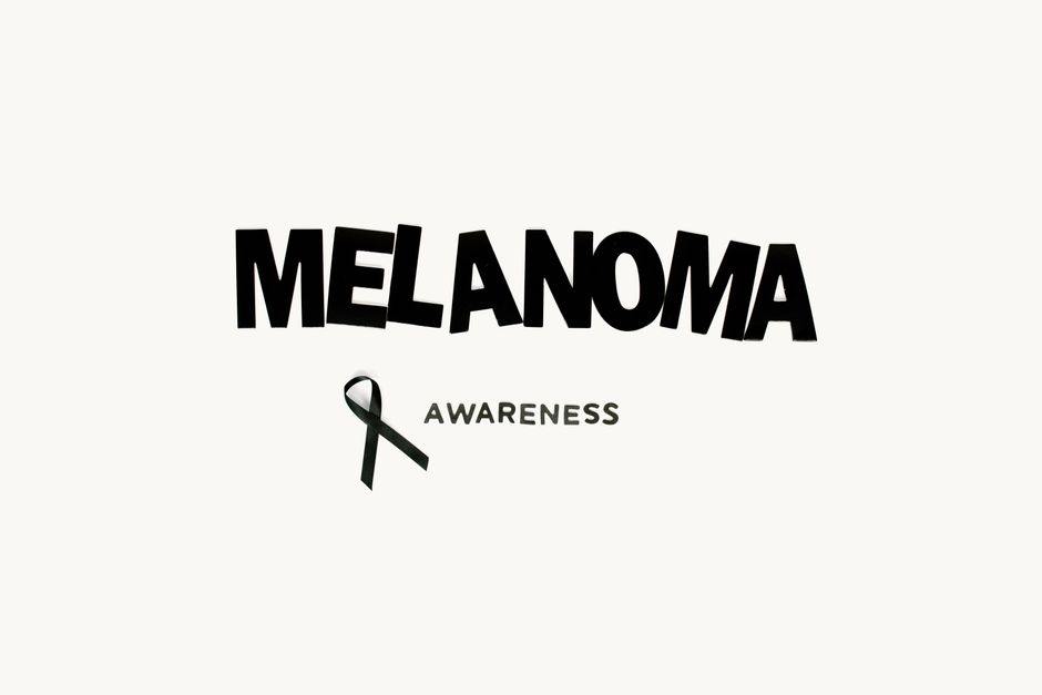 how to get checked for melanoma what to expect