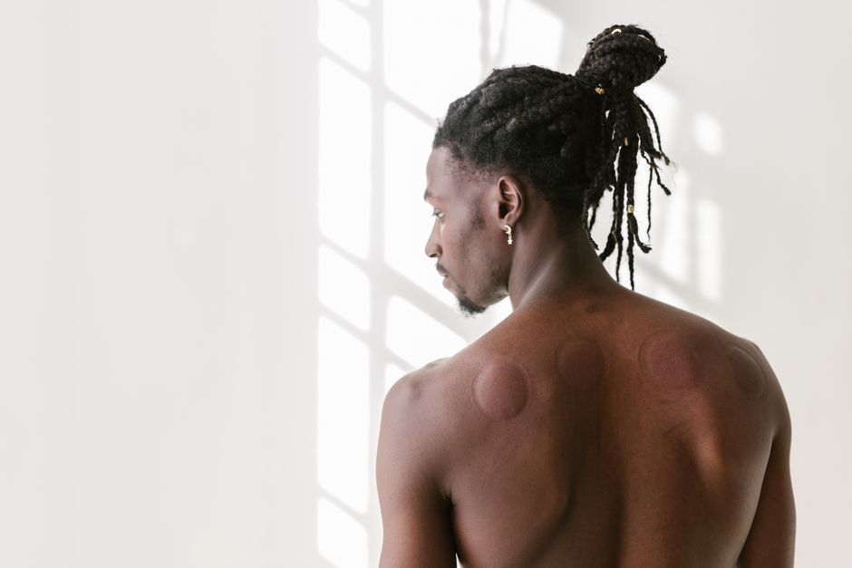 how to get rid of black marks on body