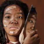 how to heal picked acne fast and avoid scars