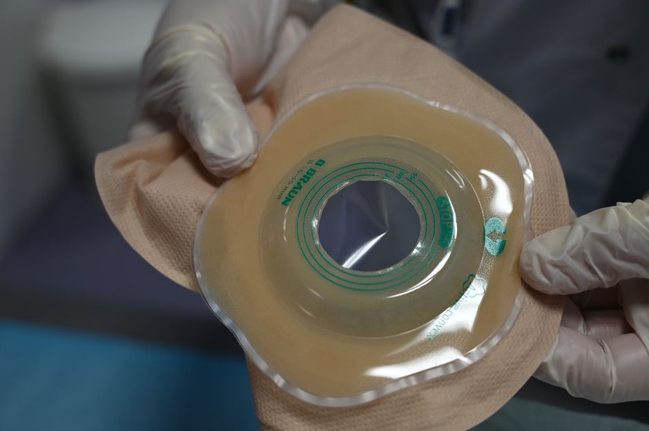 how to live with a colostomy bag tips for daily life