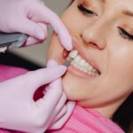 how to maintain veneers tips for long lasting results