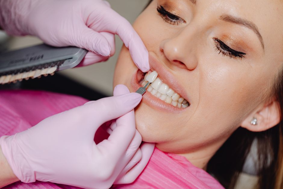 how to maintain veneers tips for long lasting results