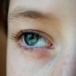 how to prevent conjunctivitis from spreading