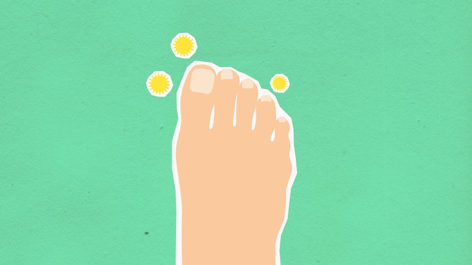 how to tell if you have a fungal infection signs