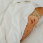 how to tell if your tailbone is bruised or broken