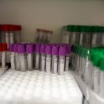 how to test air quality for asbestos costs methods