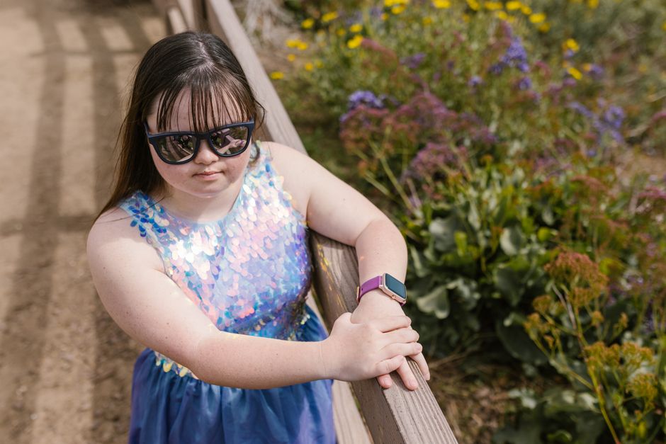 is turner syndrome an aneuploidy monosomy x explained